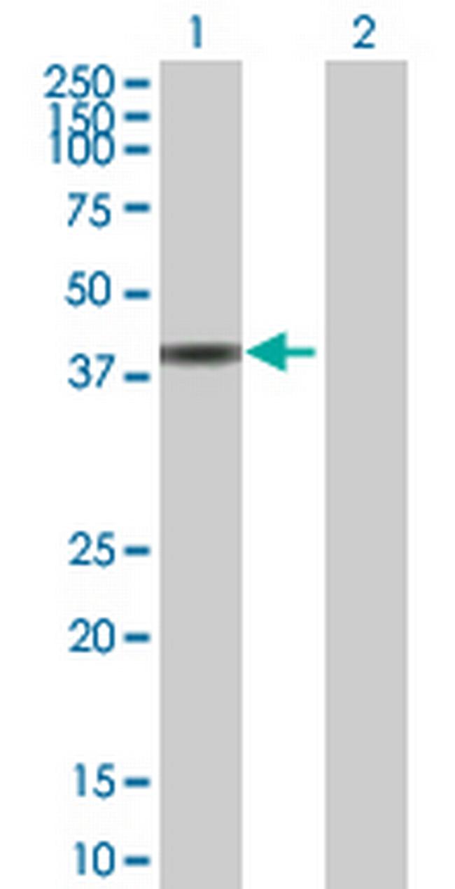 CCDC131 Antibody in Western Blot (WB)