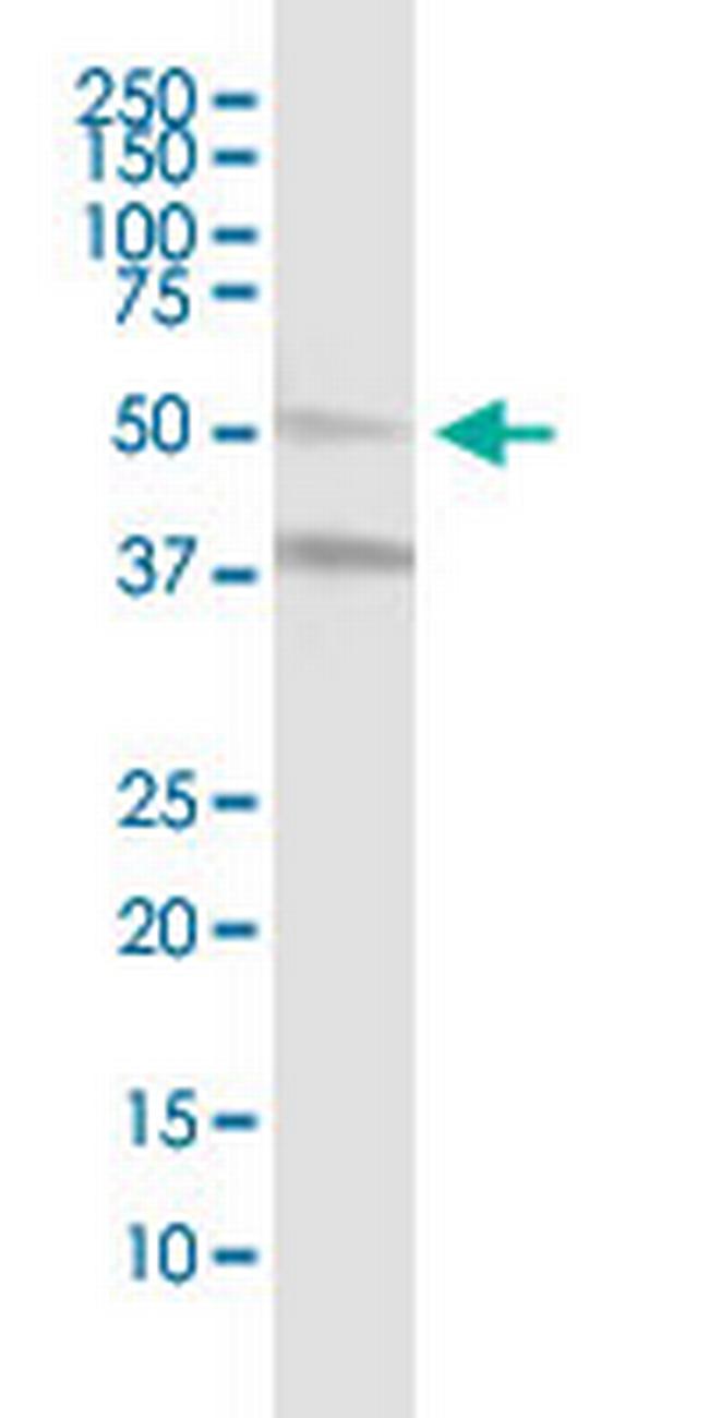 MLKL Antibody in Western Blot (WB)