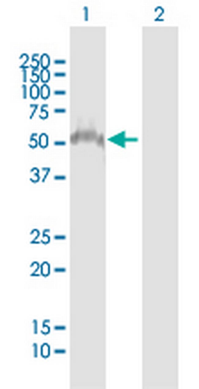 ZSCAN4 Antibody in Western Blot (WB)