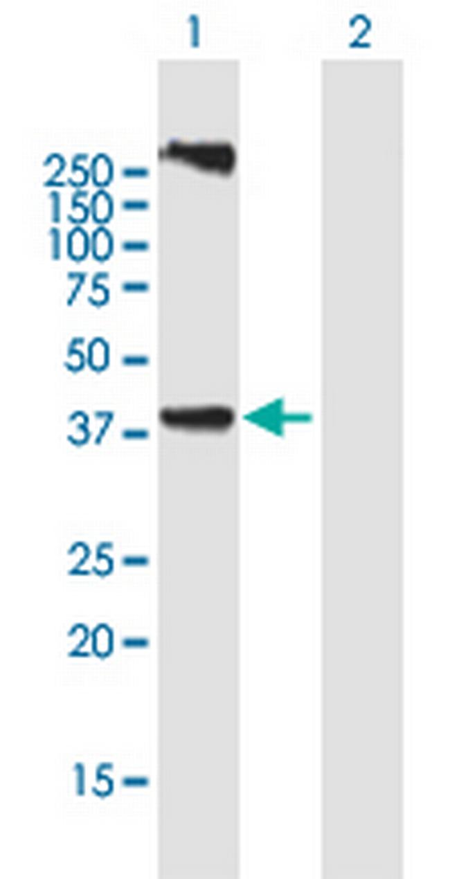 LASS3 Antibody in Western Blot (WB)