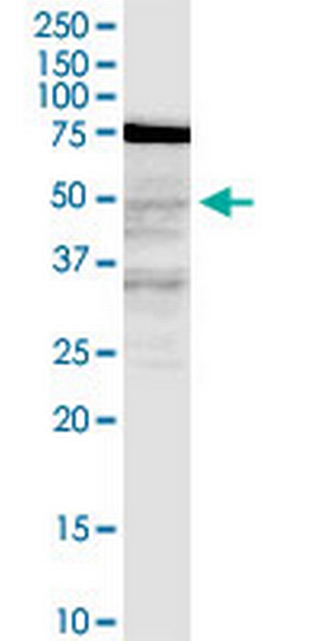 LASS3 Antibody in Western Blot (WB)