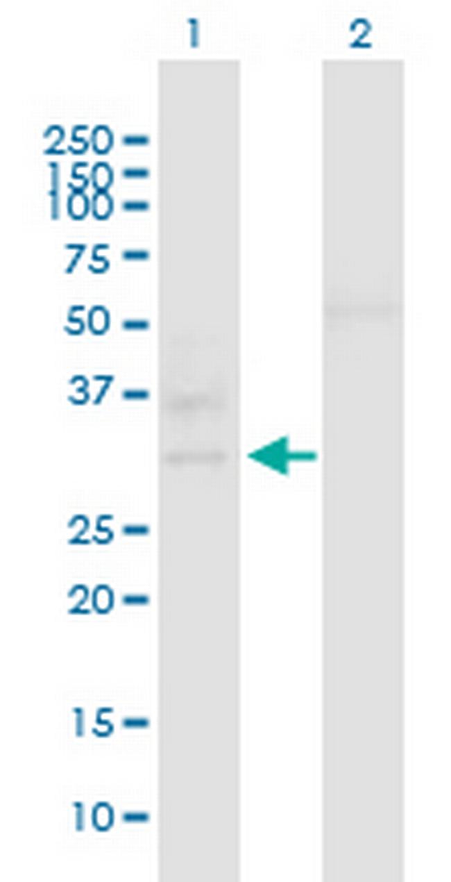 C10orf63 Antibody in Western Blot (WB)