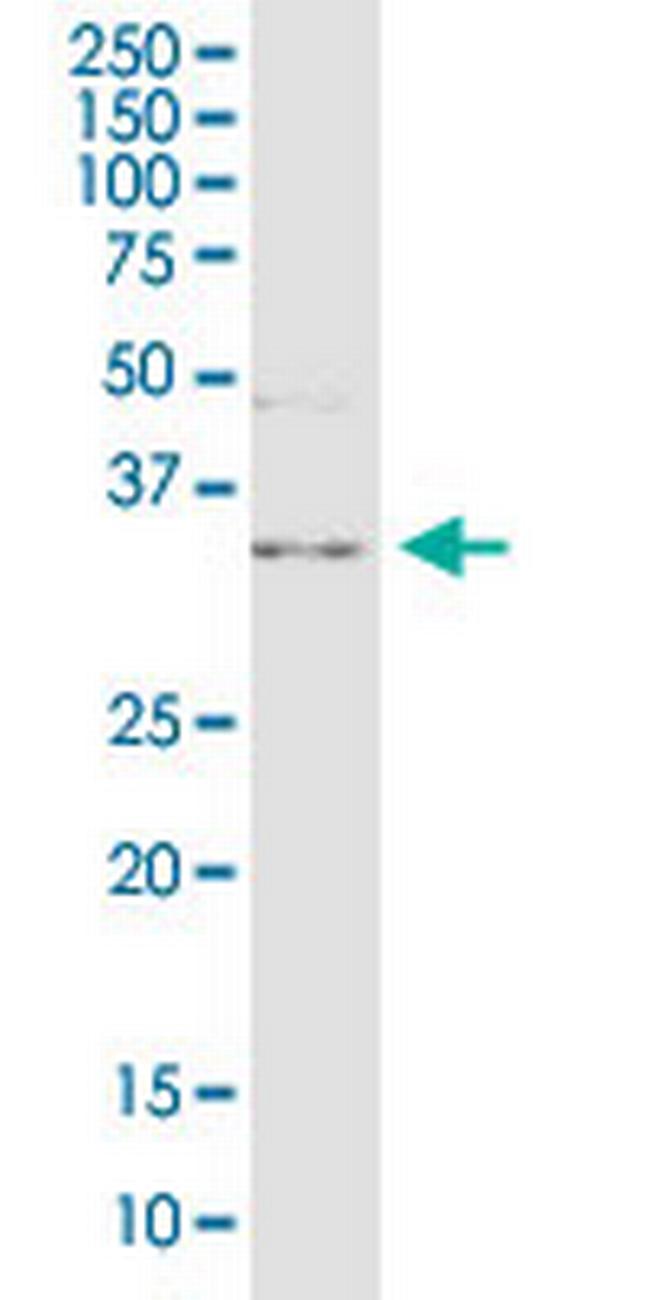 C10orf63 Antibody in Western Blot (WB)