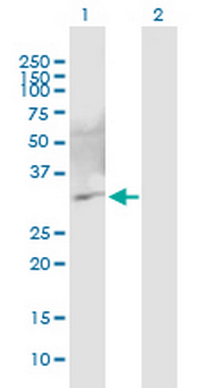 C10orf63 Antibody in Western Blot (WB)