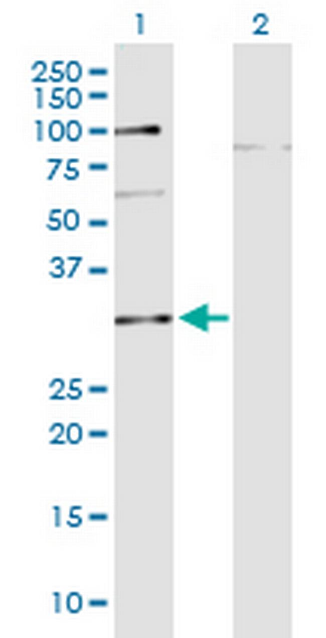 C10orf63 Antibody in Western Blot (WB)