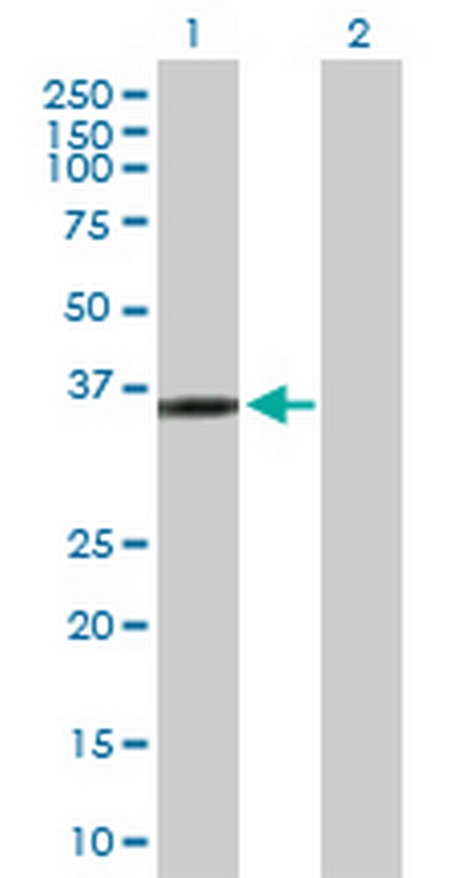 KIF6 Antibody in Western Blot (WB)