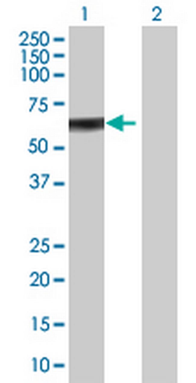 ZBTB9 Antibody in Western Blot (WB)