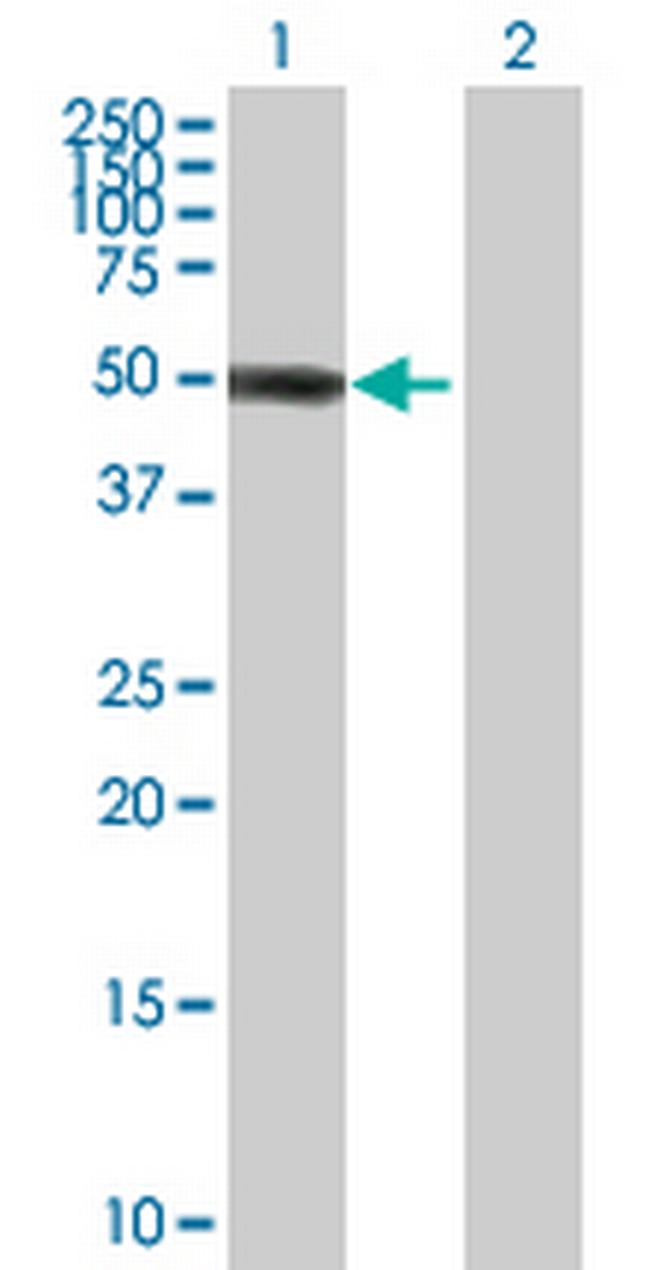 ZBTB12 Antibody in Western Blot (WB)