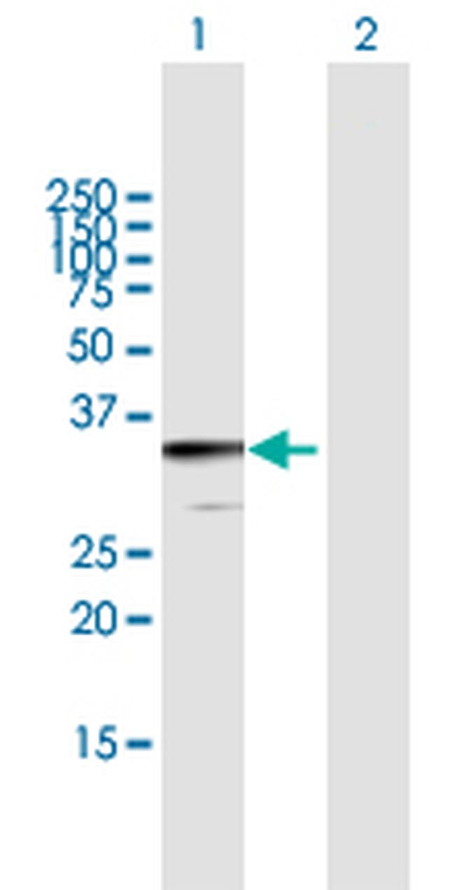 JAZF1 Antibody in Western Blot (WB)