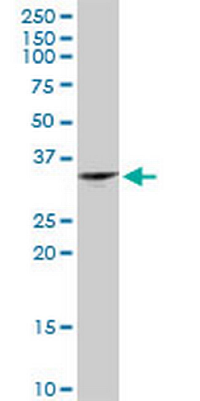JAZF1 Antibody in Western Blot (WB)