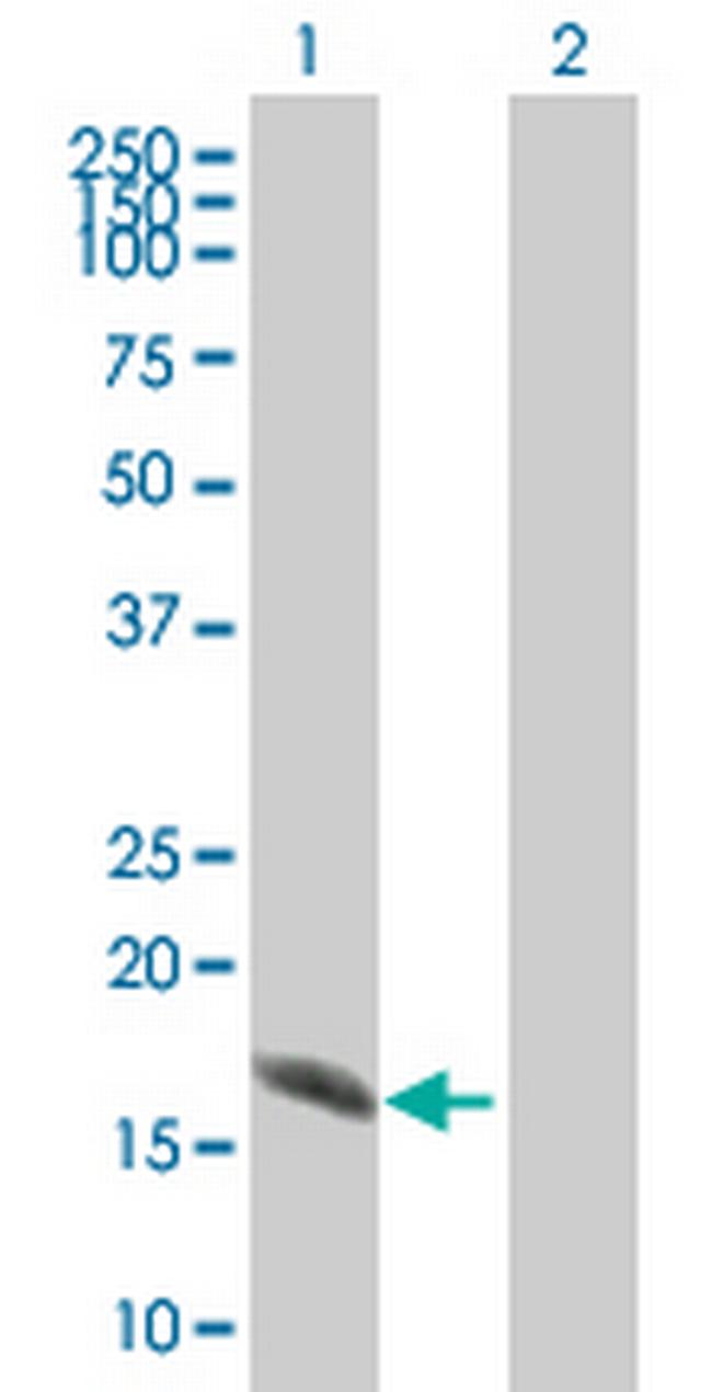 ATXN7L4 Antibody in Western Blot (WB)