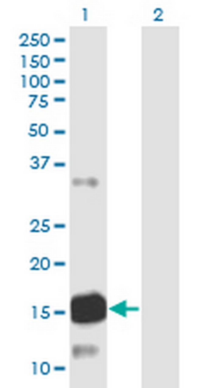 ATXN7L1 Antibody in Western Blot (WB)