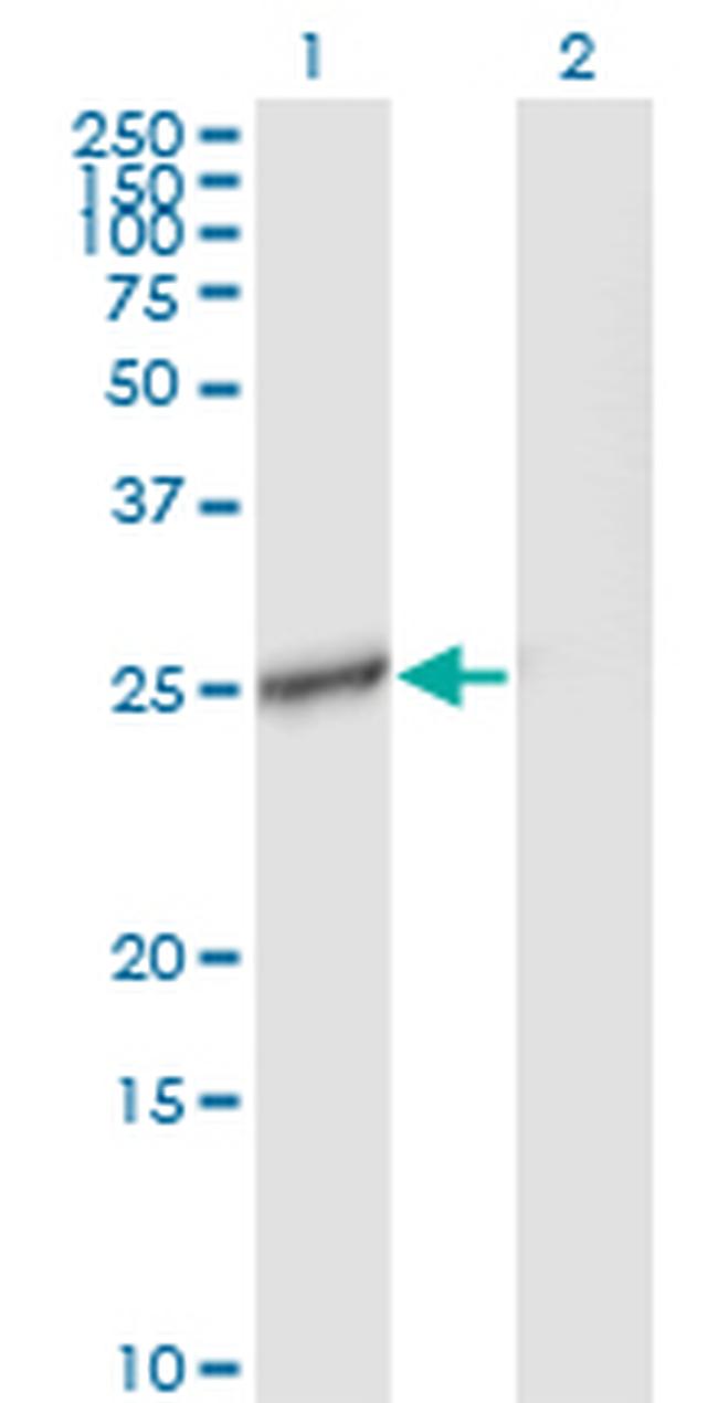 IL27 Antibody in Western Blot (WB)