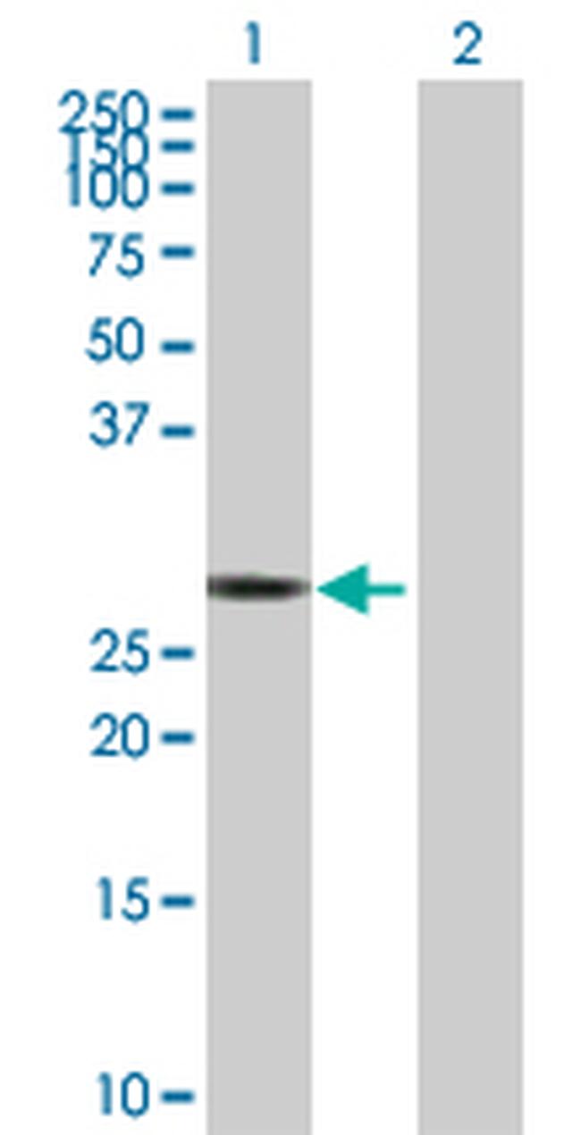 RICTOR Antibody in Western Blot (WB)