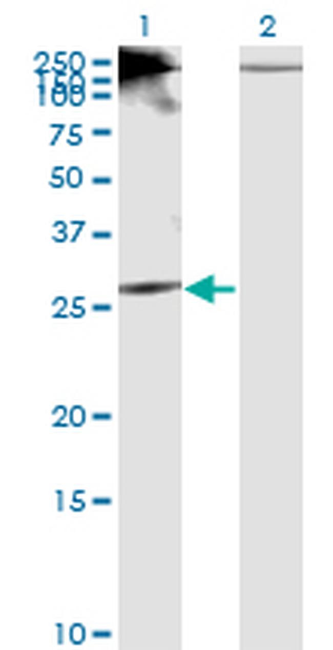 RICTOR Antibody in Western Blot (WB)