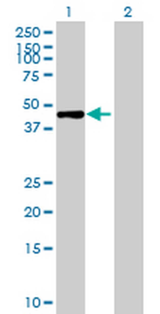 ZNF620 Antibody in Western Blot (WB)