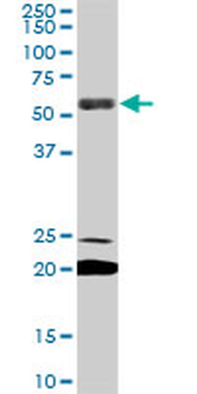 EBF3 Antibody in Western Blot (WB)