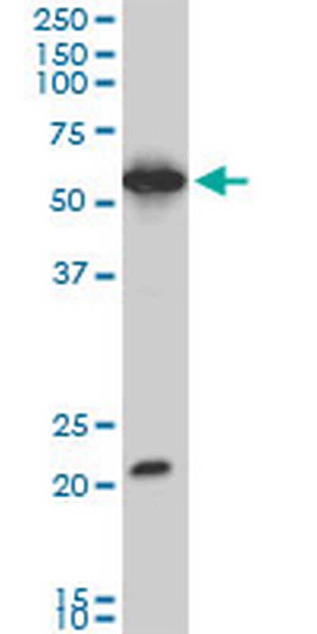 EBF3 Antibody in Western Blot (WB)