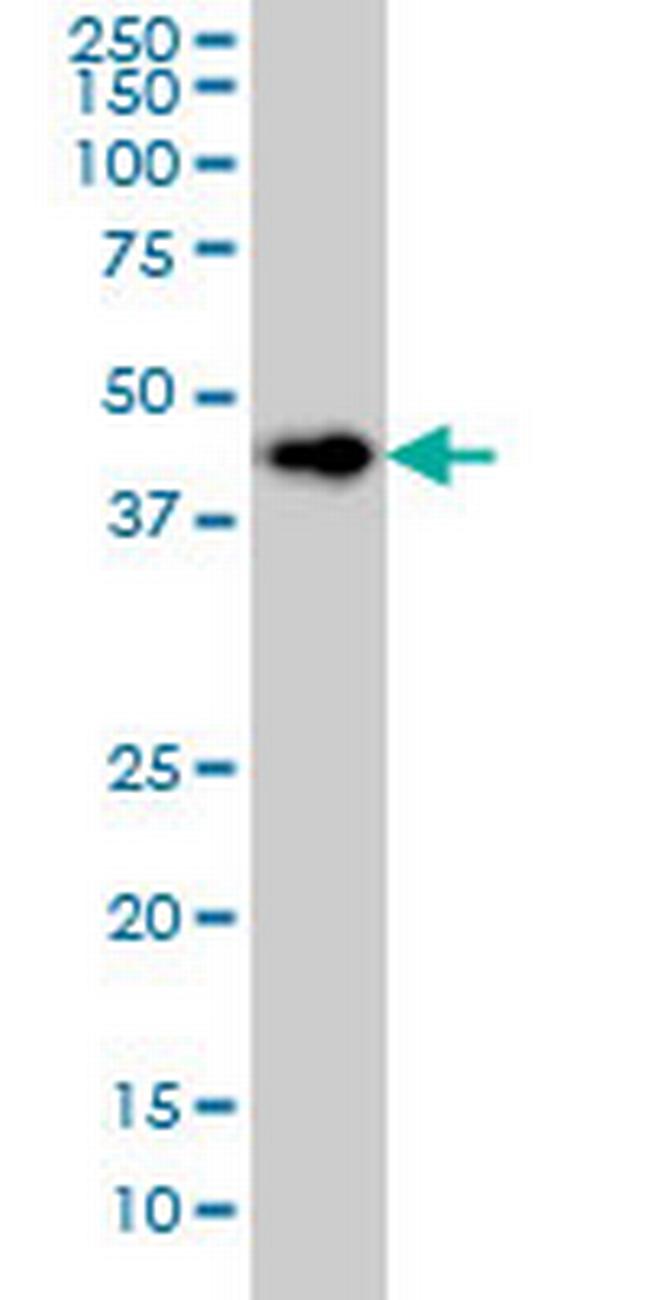 LASS6 Antibody in Western Blot (WB)