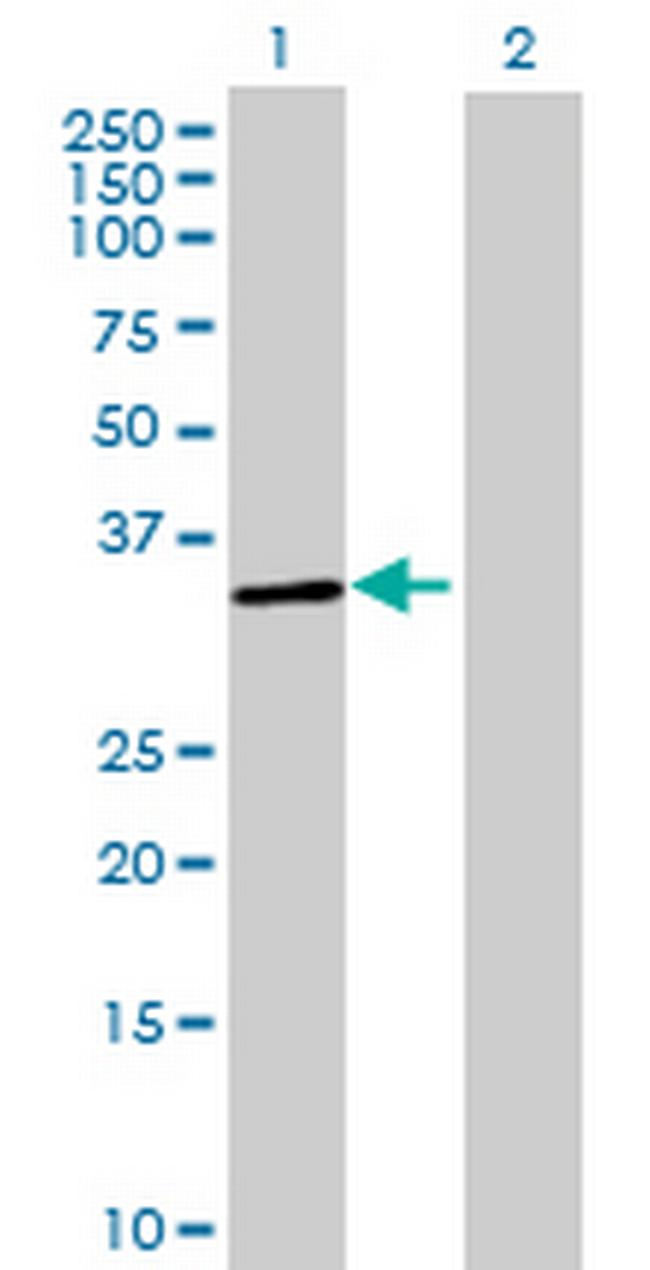 OR52B2 Antibody in Western Blot (WB)