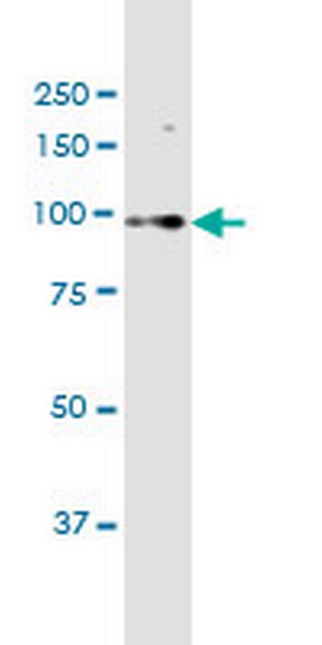 C15orf55 Antibody in Western Blot (WB)