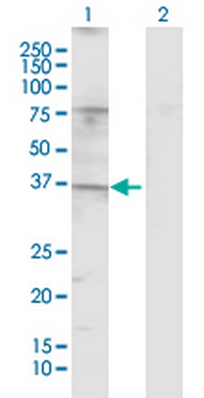 TAS2R49 Antibody in Western Blot (WB)