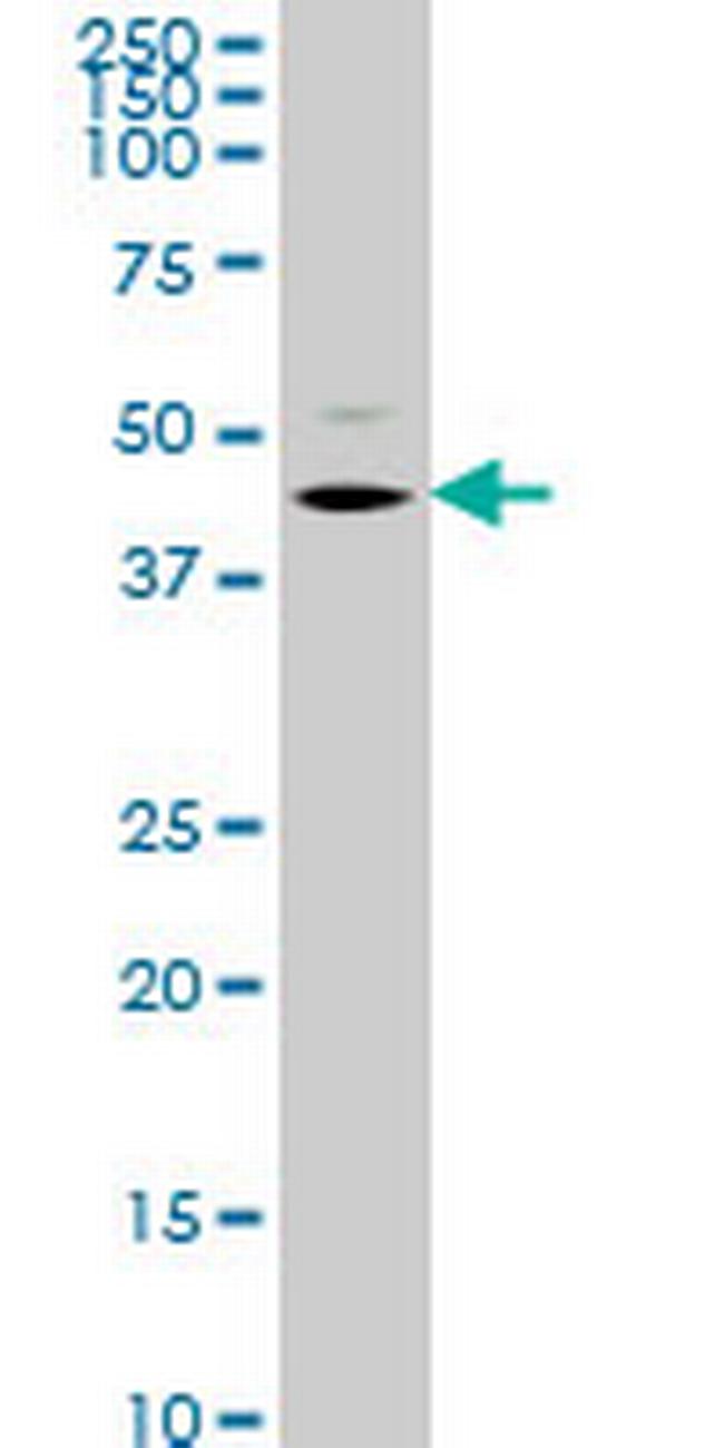 STK32C Antibody in Western Blot (WB)