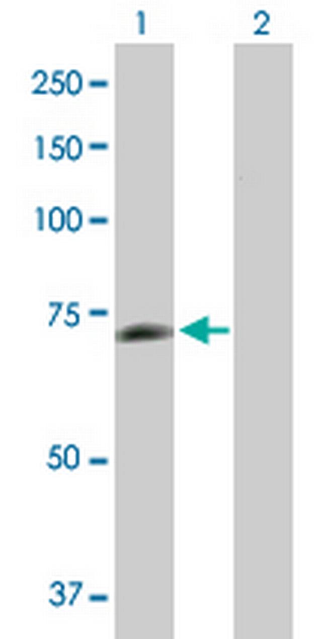 PGM2L1 Antibody in Western Blot (WB)