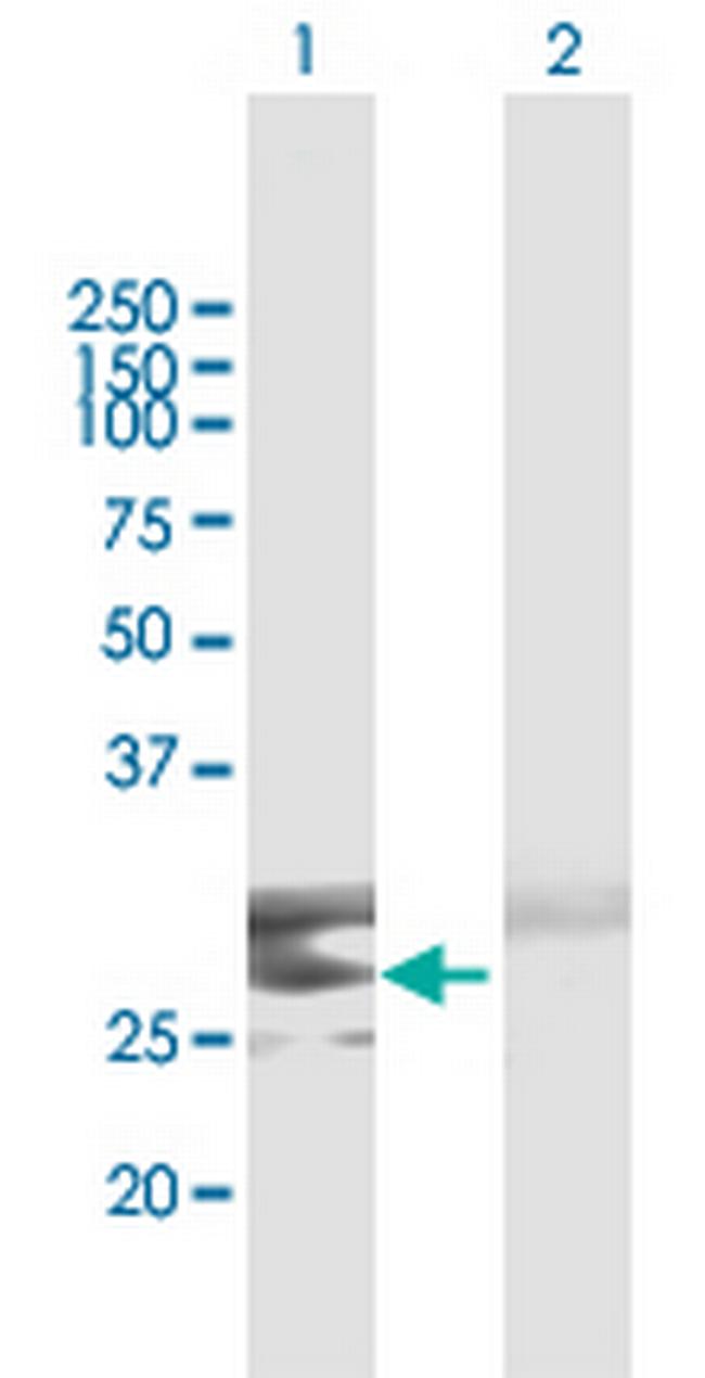 CLEC9A Antibody in Western Blot (WB)