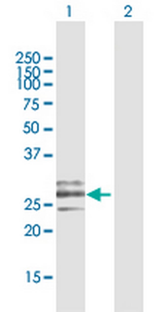 CLEC9A Antibody in Western Blot (WB)