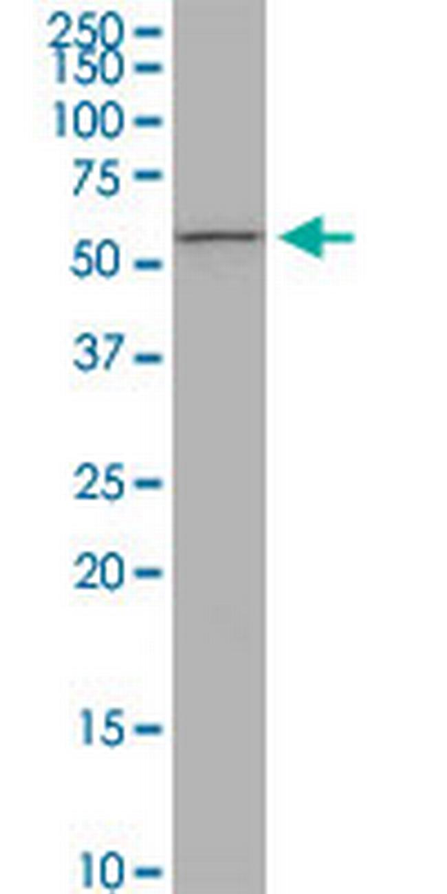 PIGW Antibody in Western Blot (WB)