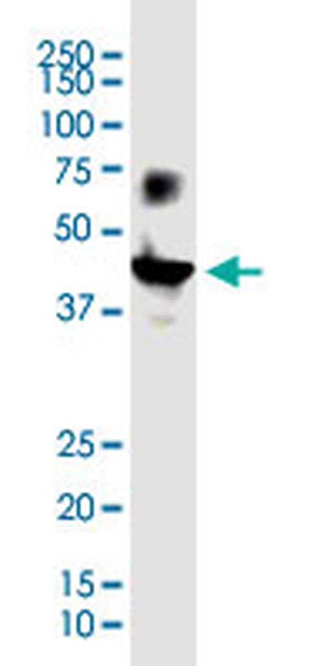 VSTM1 Antibody in Western Blot (WB)