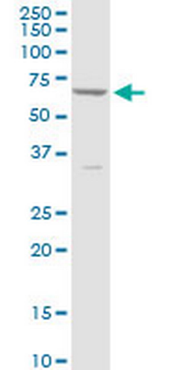 CYP4V2 Antibody in Western Blot (WB)