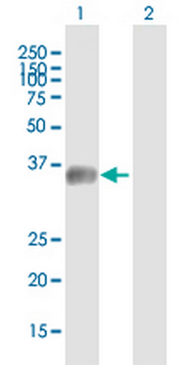 MGC34713 Antibody in Western Blot (WB)