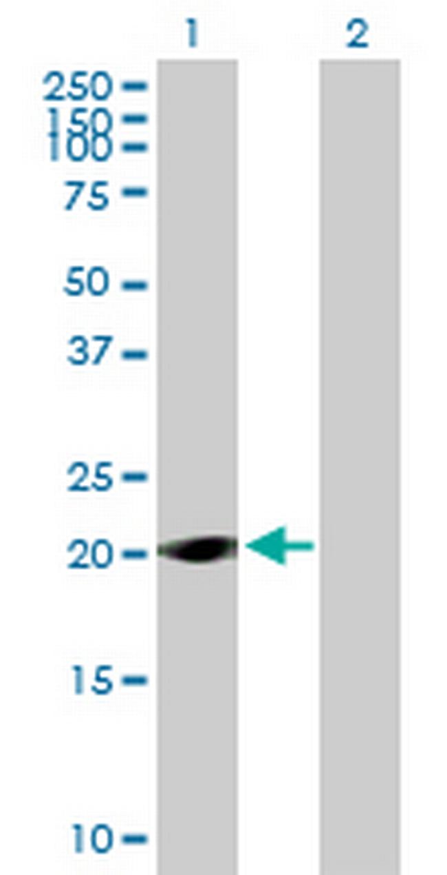 LOC285697 Antibody in Western Blot (WB)