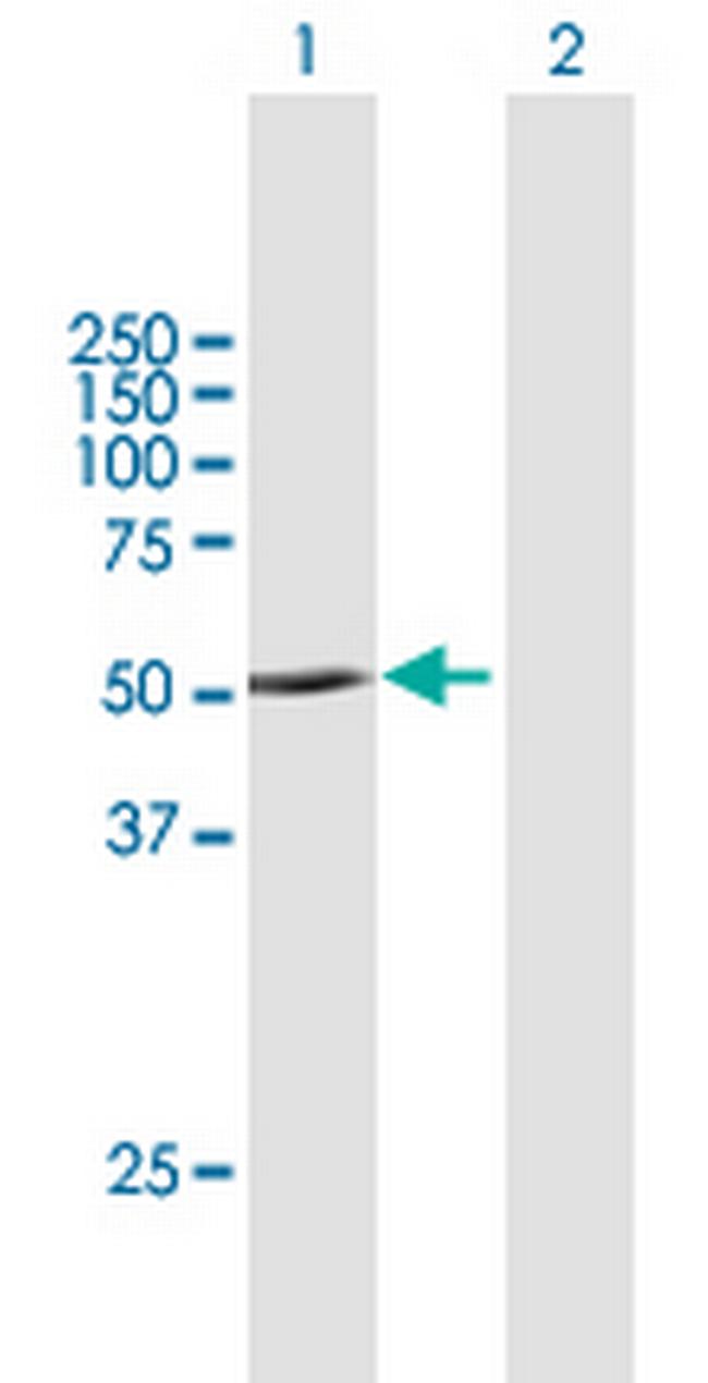 PNPLA1 Antibody in Western Blot (WB)