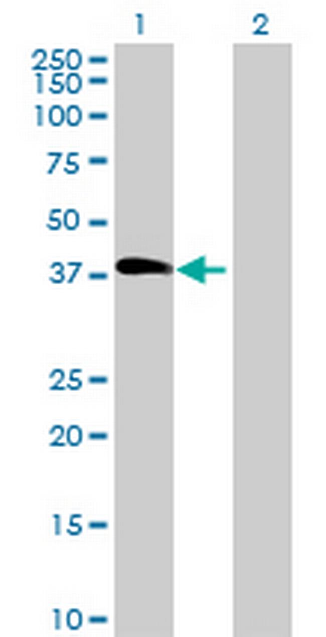 LCN12 Antibody in Western Blot (WB)