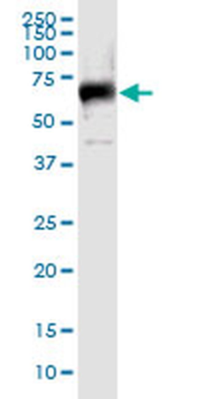 ILDR1 Antibody in Western Blot (WB)