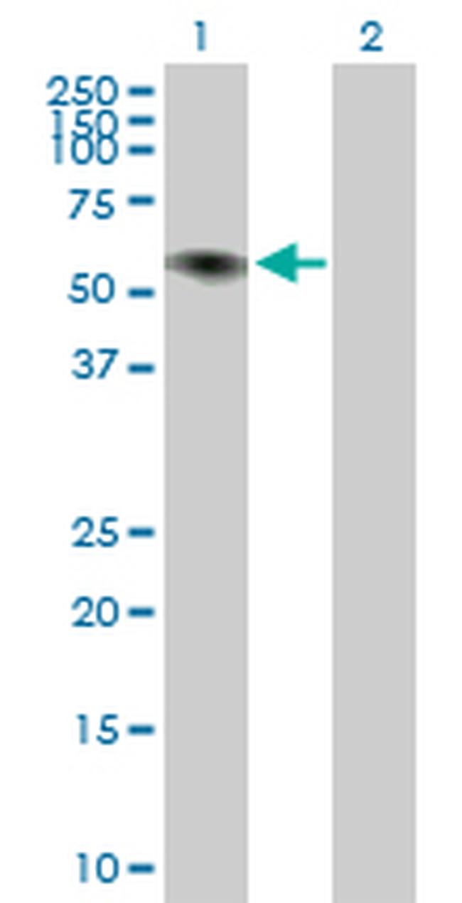 ILDR1 Antibody in Western Blot (WB)