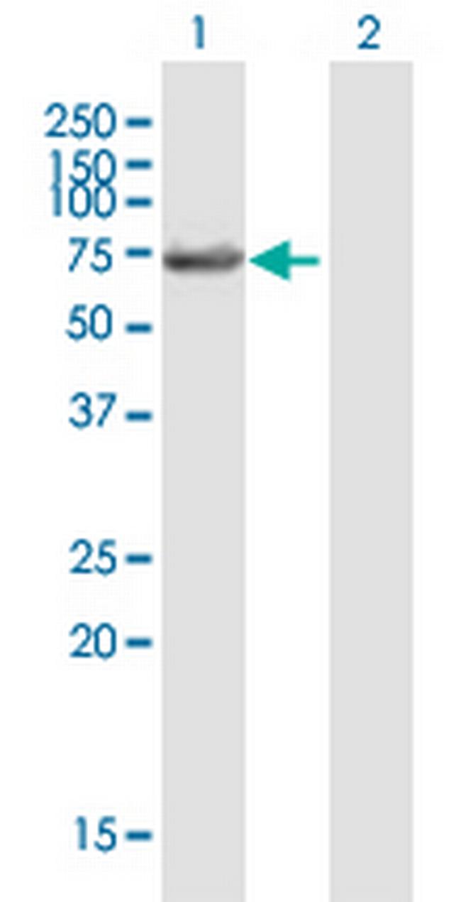 LIN9 Antibody in Western Blot (WB)