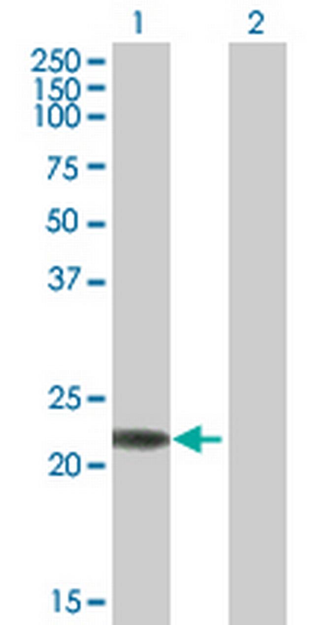 RAB7B Antibody in Western Blot (WB)