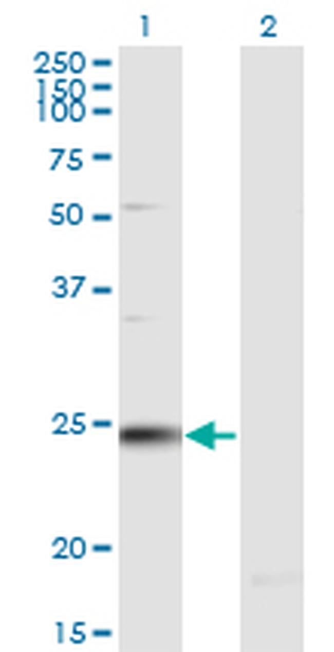 RAB7B Antibody in Western Blot (WB)