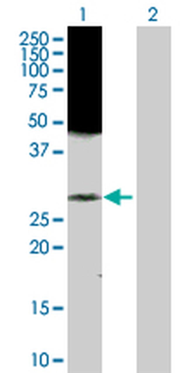 RAB43 Antibody in Western Blot (WB)