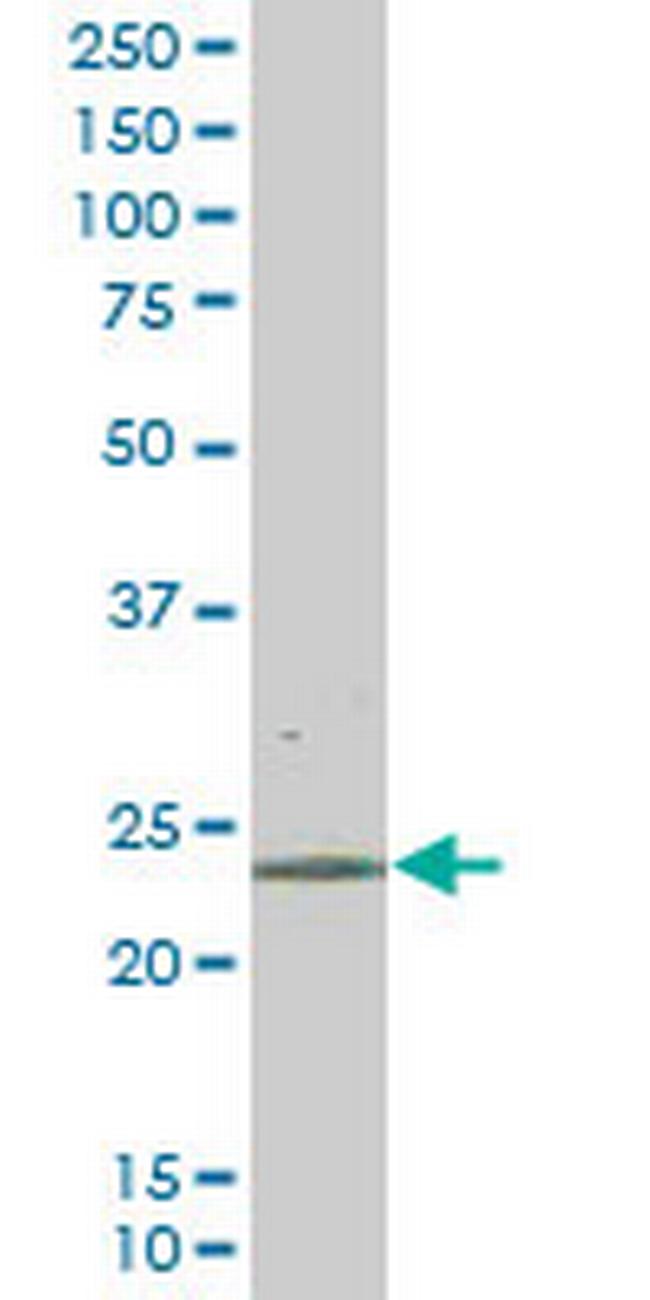 RAB43 Antibody in Western Blot (WB)