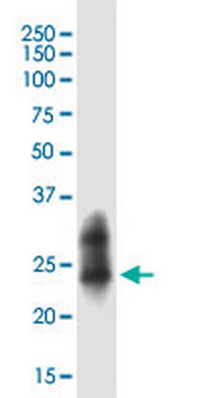 RAB43 Antibody in Western Blot (WB)