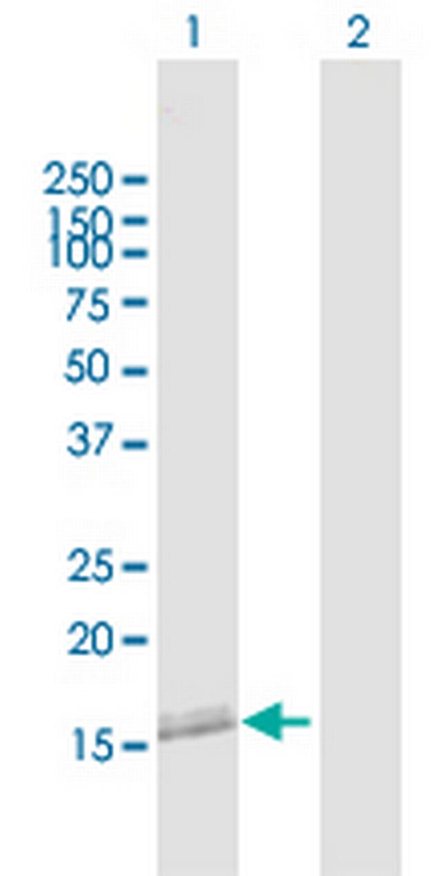 NANOS2 Antibody in Western Blot (WB)