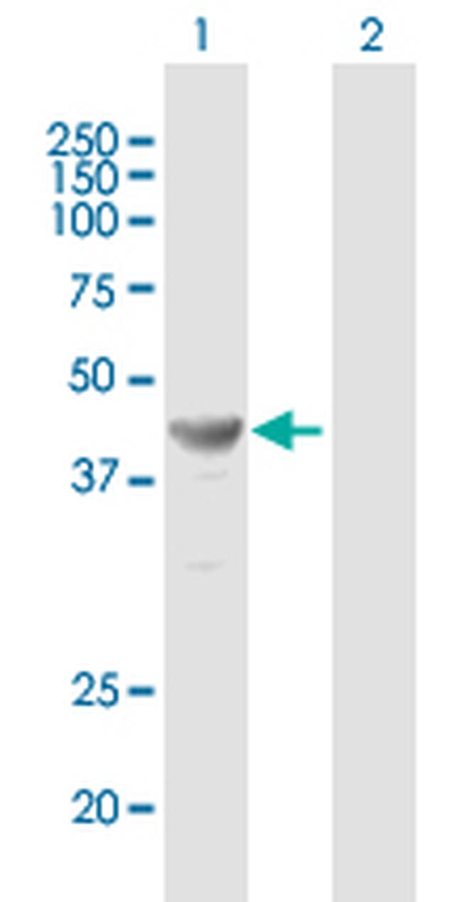 TFAP2E Antibody in Western Blot (WB)