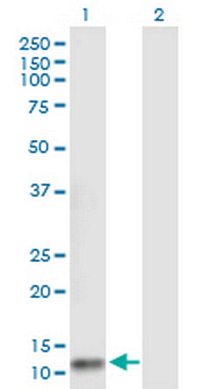 FLJ37478 Antibody in Western Blot (WB)