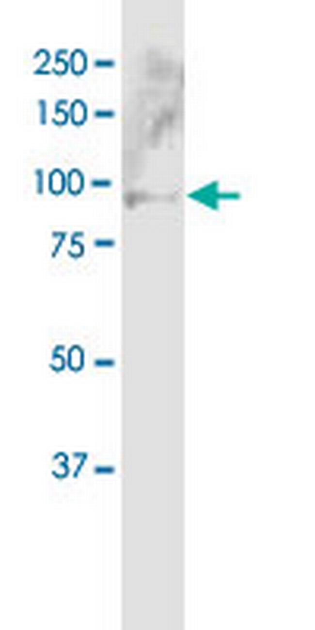 ABCB5 Antibody in Western Blot (WB)