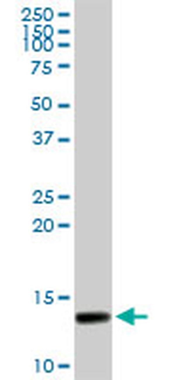 SYCN Antibody in Western Blot (WB)